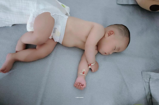 燕郊六个月宝宝眼睛散光 燕郊六个月宝宝眼睛散光